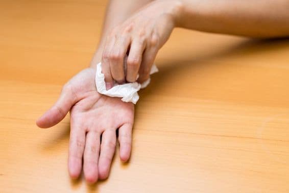 Frau leidet unter schwitzigen Händen.